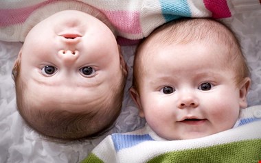چرا برخی دوقلوها به هم میچسبند؟