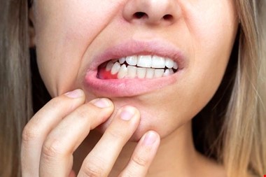 عواقب خطرناک مسواک نزدن برای دهان و دندان