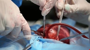 واردات داروی بیماران پیوندی / رفع مشکل تولیدکننده ایرانی این دارو