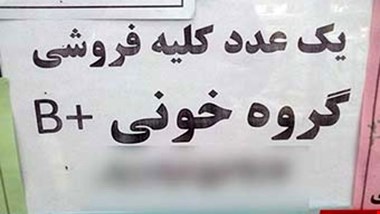 عراقی ها خریدار «کلیه» ایرانیان به قیمت دلار!