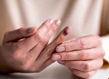 بیحس شدن بدن نگران کننده است؟ + علت و درمان