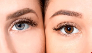 مگسپران چشم نشانه یک بیماری جدی است؟