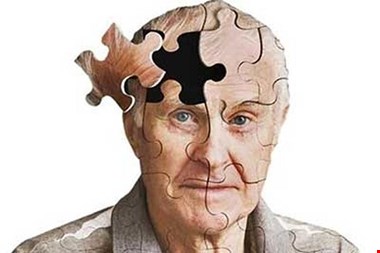 آلودگی هوا میتواند روند پیشرفت آلزایمر را تسریع کند