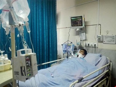 امکان بازگشت مرگ مغزی چقدر است؟