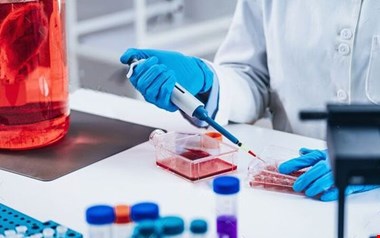 نیاز جدی بازار سلول‌درمانی کشور به محصولات مجاز