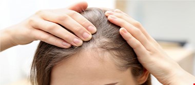 چه چیزهایی ریزش مو را متوقف میکند؟