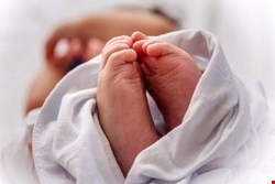 وزارت بهداشت در ماجرای سقط «سندروم داون» بیانیه داد