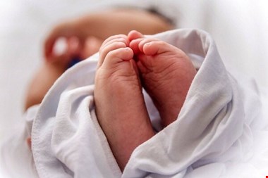 وزارت بهداشت در ماجرای سقط «سندروم داون» بیانیه داد