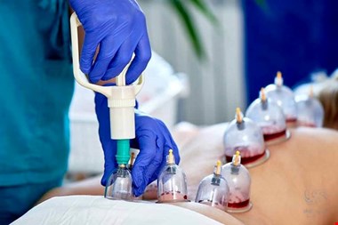 بهترین زمان حجامت چه موقع است؟