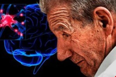 ارتباط سندرم متابولیک با بیماری پارکینسون