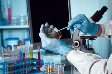 سازمان انتقال خون می تواند محور توسعه بانک سلول‌های بنیادی باشد