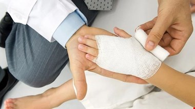 رایجترین باورهای غلط در هنگام سوختگی+ راهکارهای مناسب