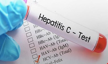 برنامه وزارت بهداشت برای حذف هپاتیت C در کشور
