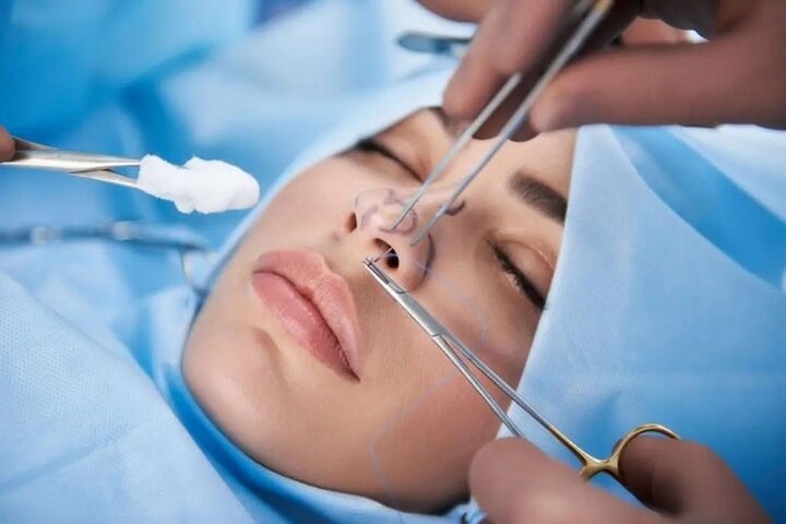 افزایش شکایات از جراحی‌های زیبایی