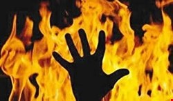 نمایشگاه عکس و قصه‌ رهیدگان سوختگی برگزار می‌شود