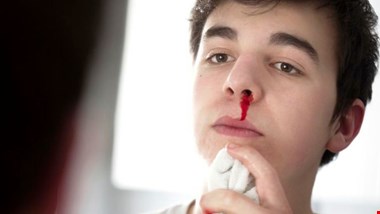 بدن چگونه جلوی خونریزی را میگیرد؟