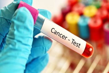 پوشش بیمه ۳ سرطان شایع در دستورکار/برقراری پوشش آزمایشات HPV